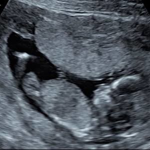 Meet your Posher, Josue